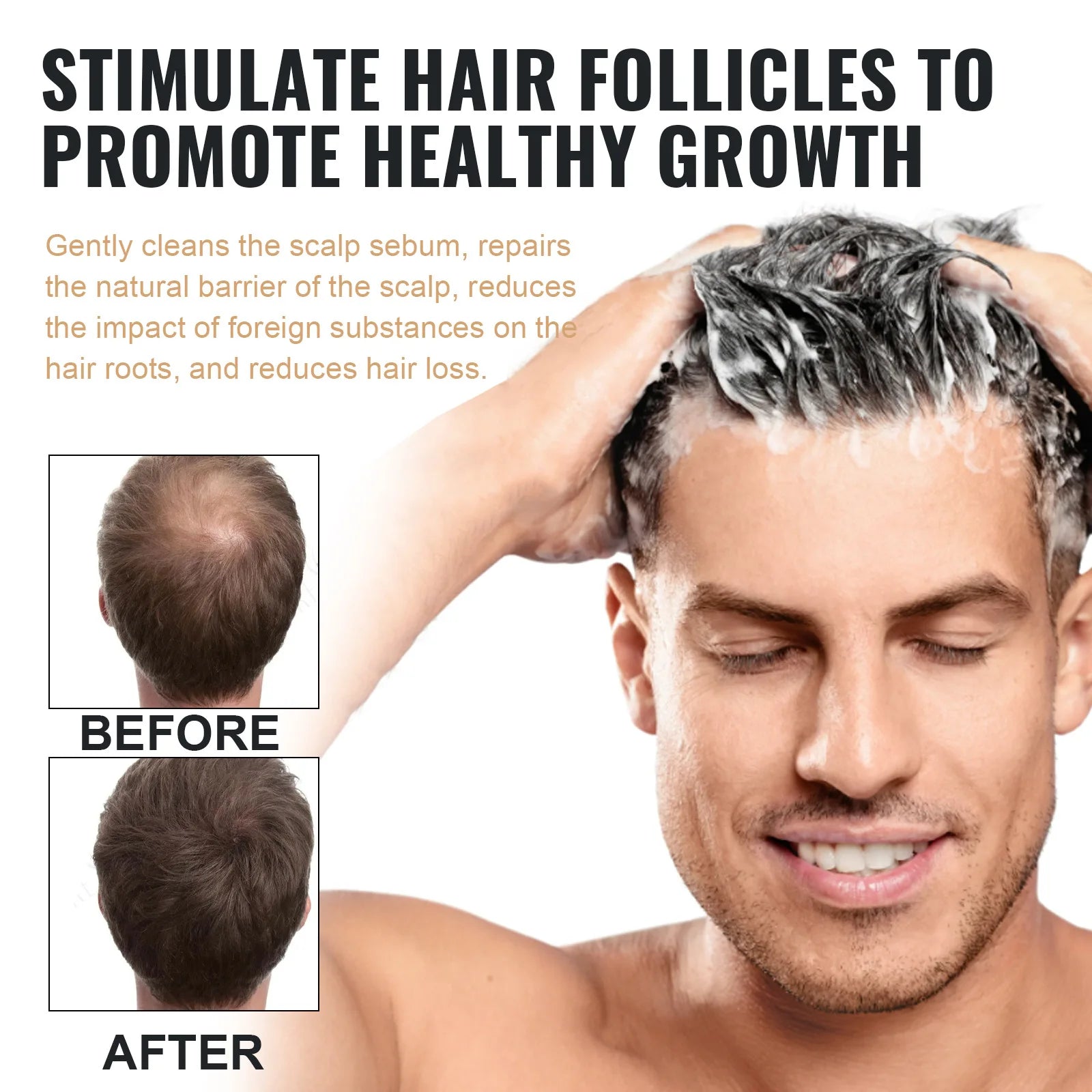 Hair Loss Treatment Shampoo