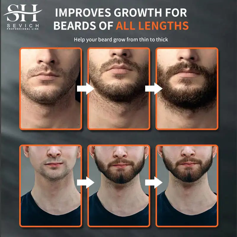Chebe Beard Growth Oil