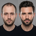 Hair Revival Kit