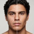 Facial skin fix kit